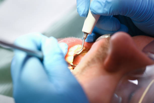 Best Dental Abscess Treatment in Marion, PA
